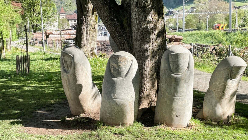 So sah die Hand vor ihrer Maniküre aus. 