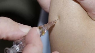 Mehr als zehn Millionen Menschen steckten sich im vergangenen Jahr mit Masern an. Massenimpfungen könnten Millionen vor dem Tod bewahren, ist die Weltgesundheitsorganisation WHO überzeugt. (Archivbild)